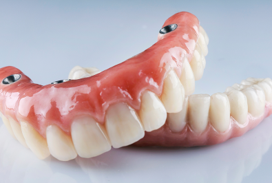 Dental Implants Explained: The Full Patient Journey from Consultation to Final Tooth