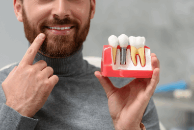 Dental Implants Explained: The Full Patient Journey from Consultation to Final Tooth